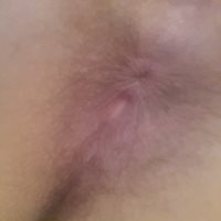 My ass hole