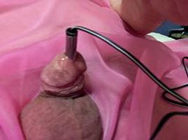 Electrostim urethral sound 5