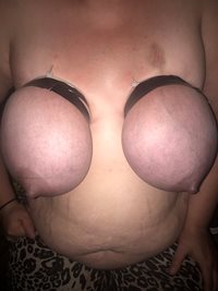 Taped tits turning purple