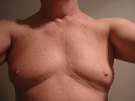 Mans small boobs and small nipples