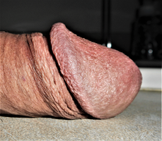 An HD picture of my penis head.
