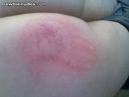 my hubbys handprint on my ass! LOL